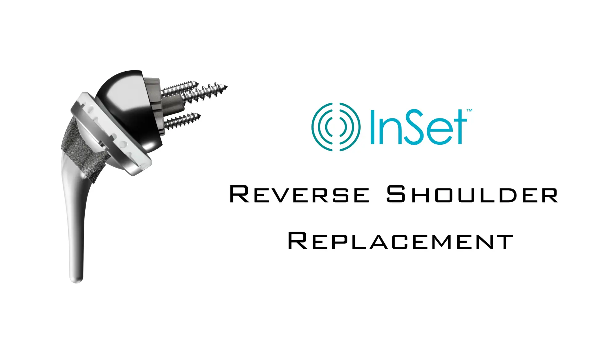 InSet™ Reverse Shoulder