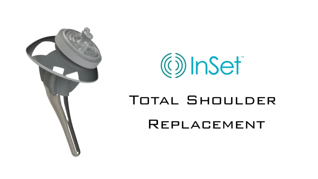 InSet™ total shoulder replacement implant