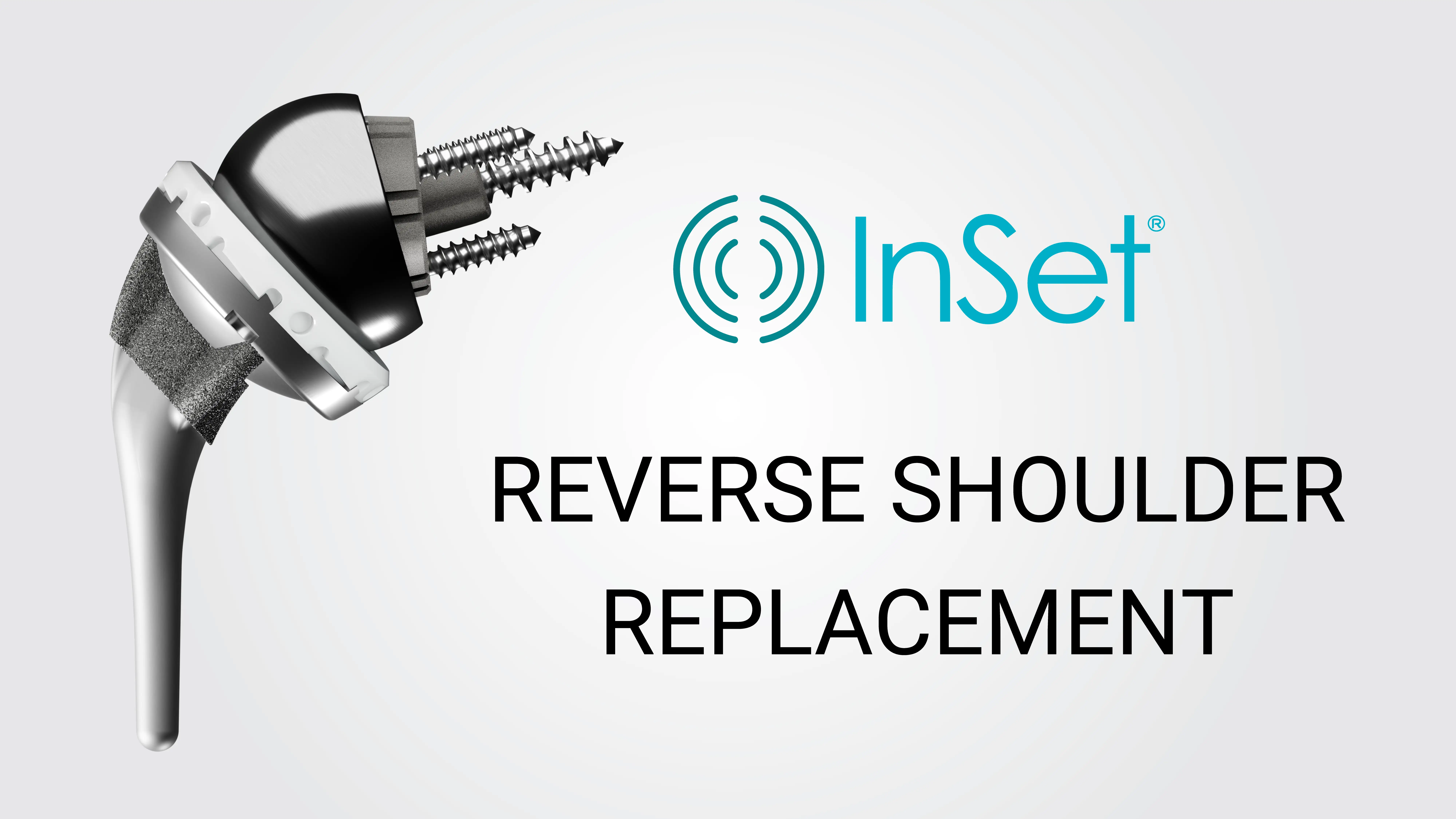 InSet® Reverse Shoulder Replacement Implant