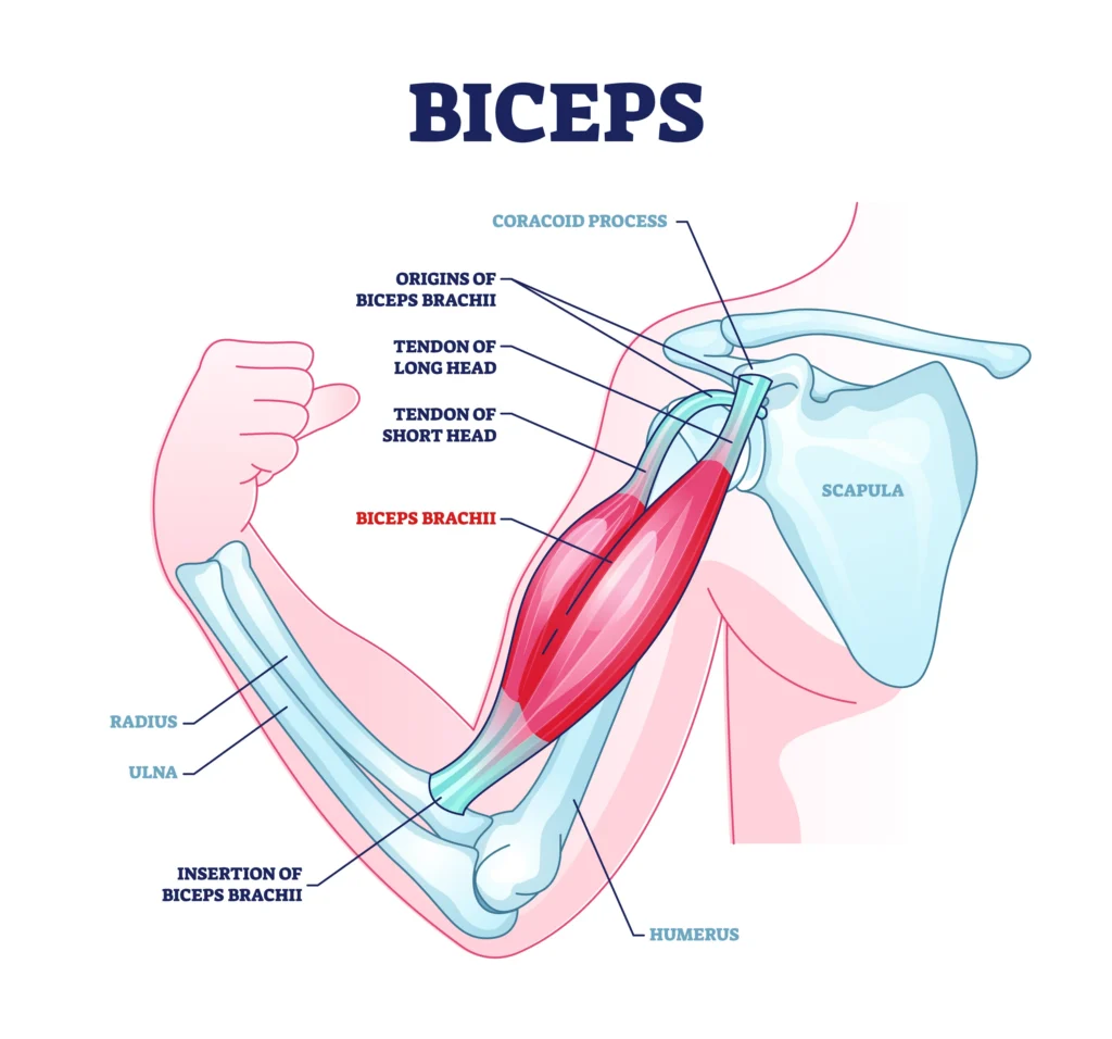 biceps tenodesis diagram